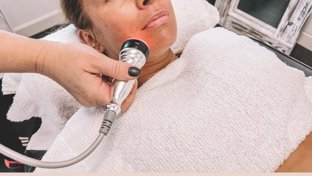 Radio Frequency Facial
