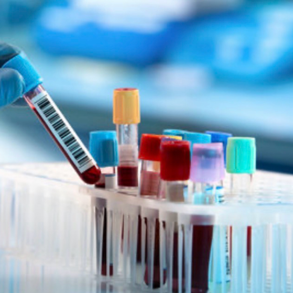 Weightloss Labs at Cherished Aesthetics in Snellville, GA
