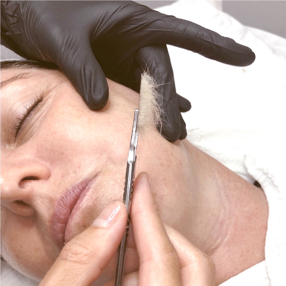 Dermaplaning Facial