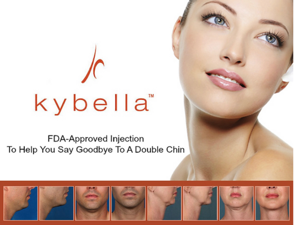 Kybella