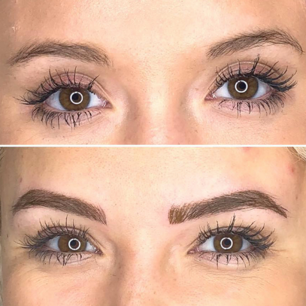 Microblading Consult at Innovative Medical Aesthetics in Slidell, LA
