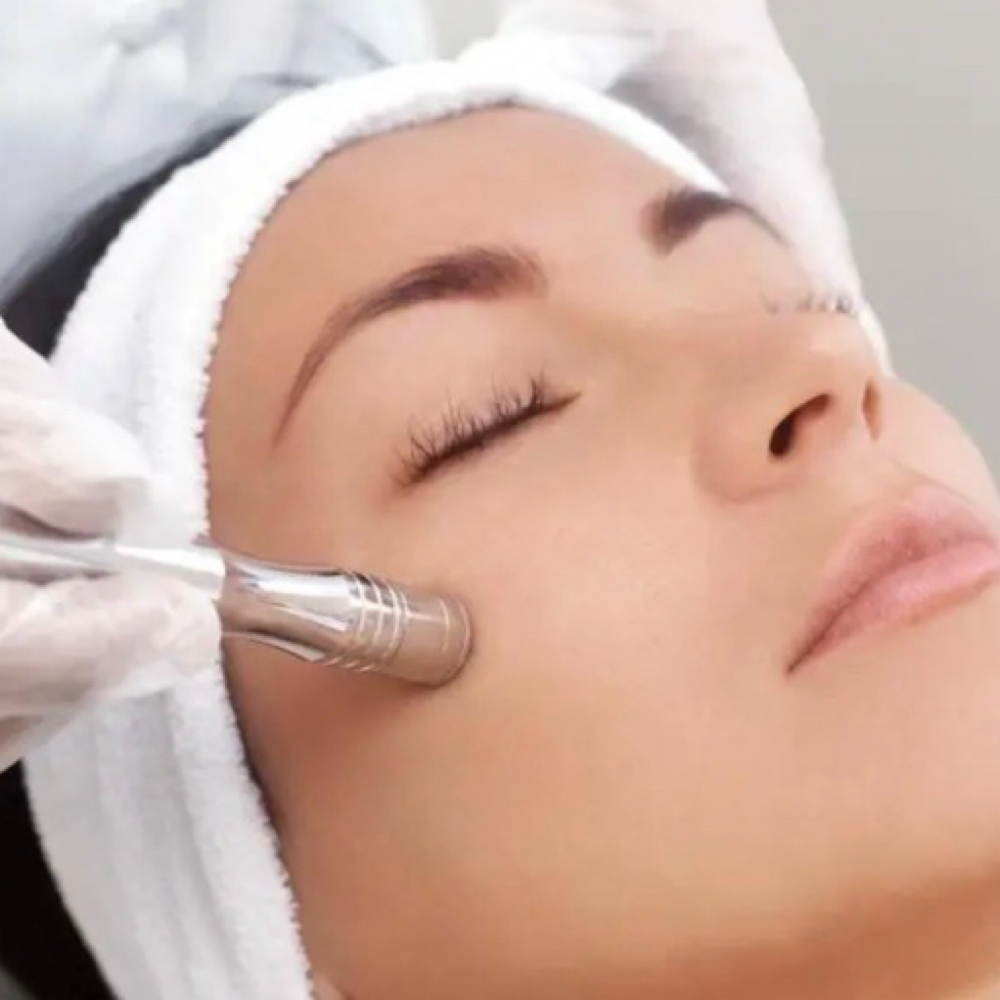 Microdermabrasion at Velin Beauty in Redwood City, CA