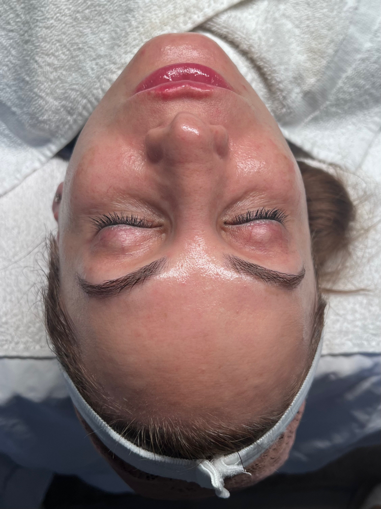 Deluxe Dermaplane Facial