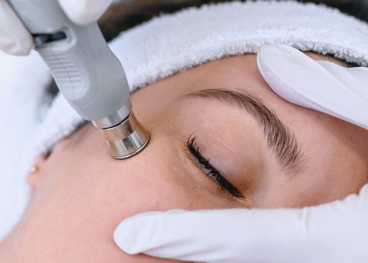 Microdermabrasion Add On
