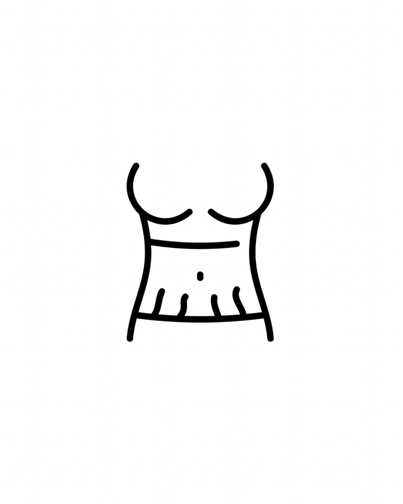 Medium Area Stretch Marks/ Burns