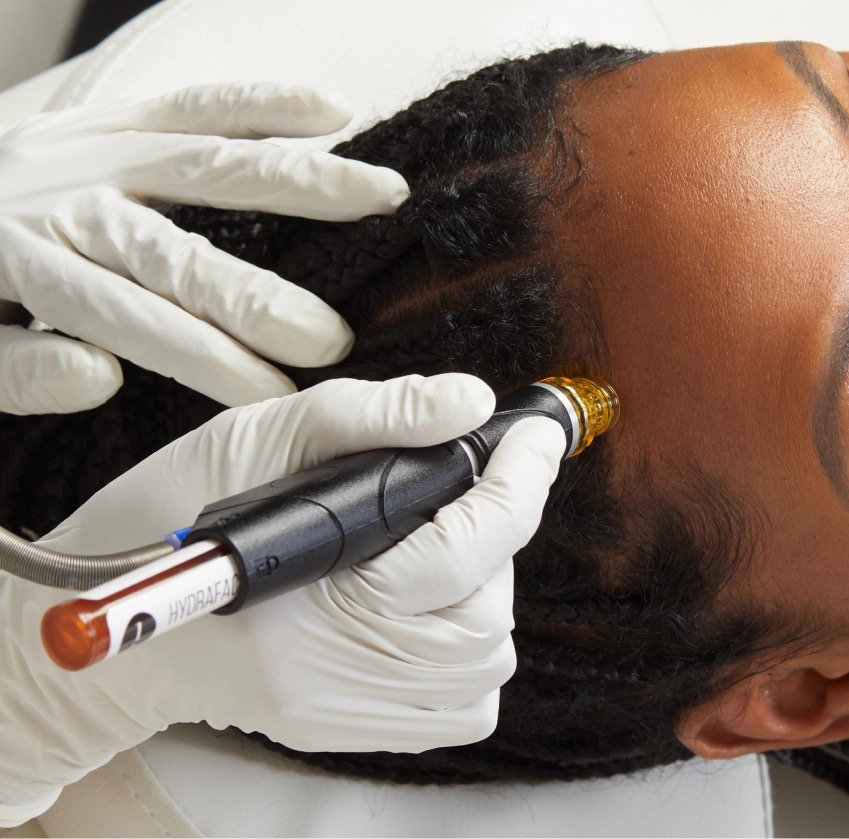 SCALP HYDRAFACIAL