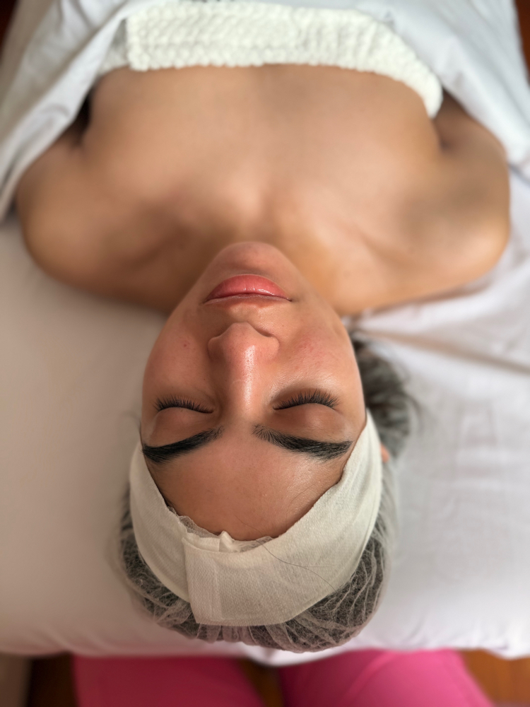 Acne Facial