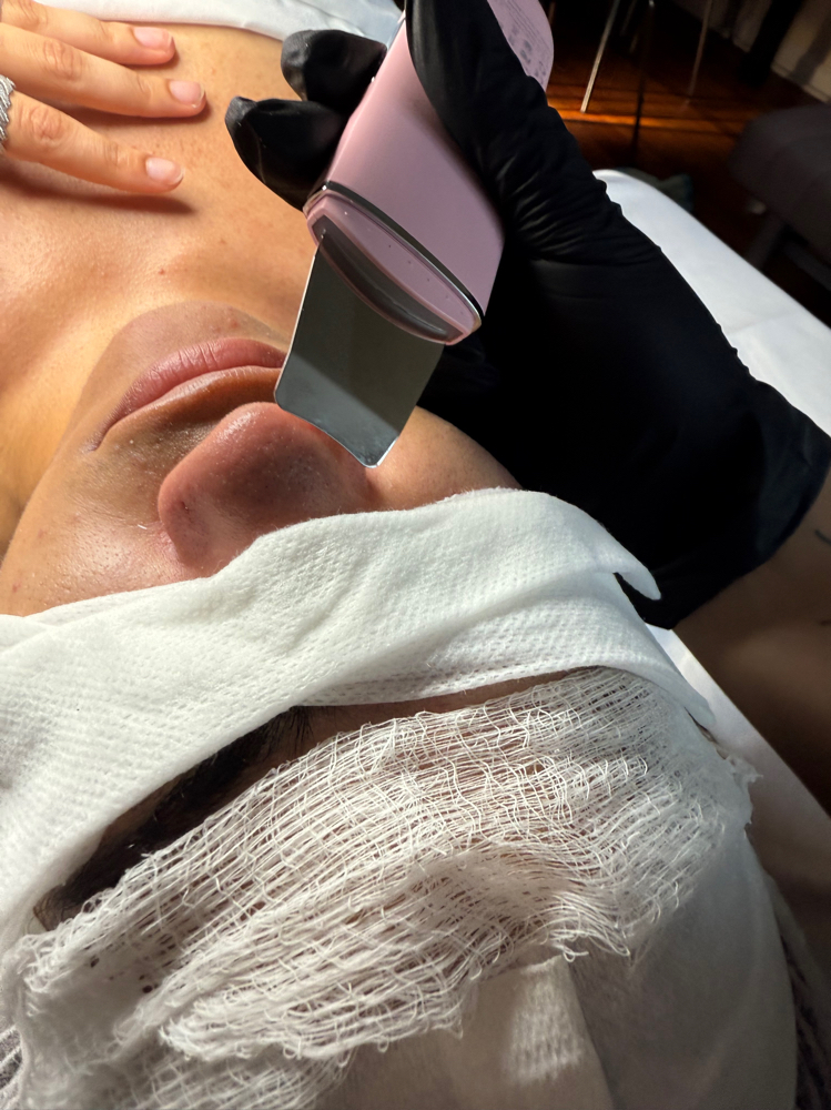Acne Purifying Treatment at In His Image Esthetics in Rosedale, NY