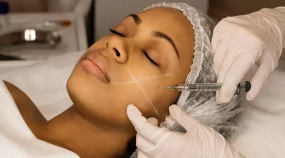 Dermal Fillers