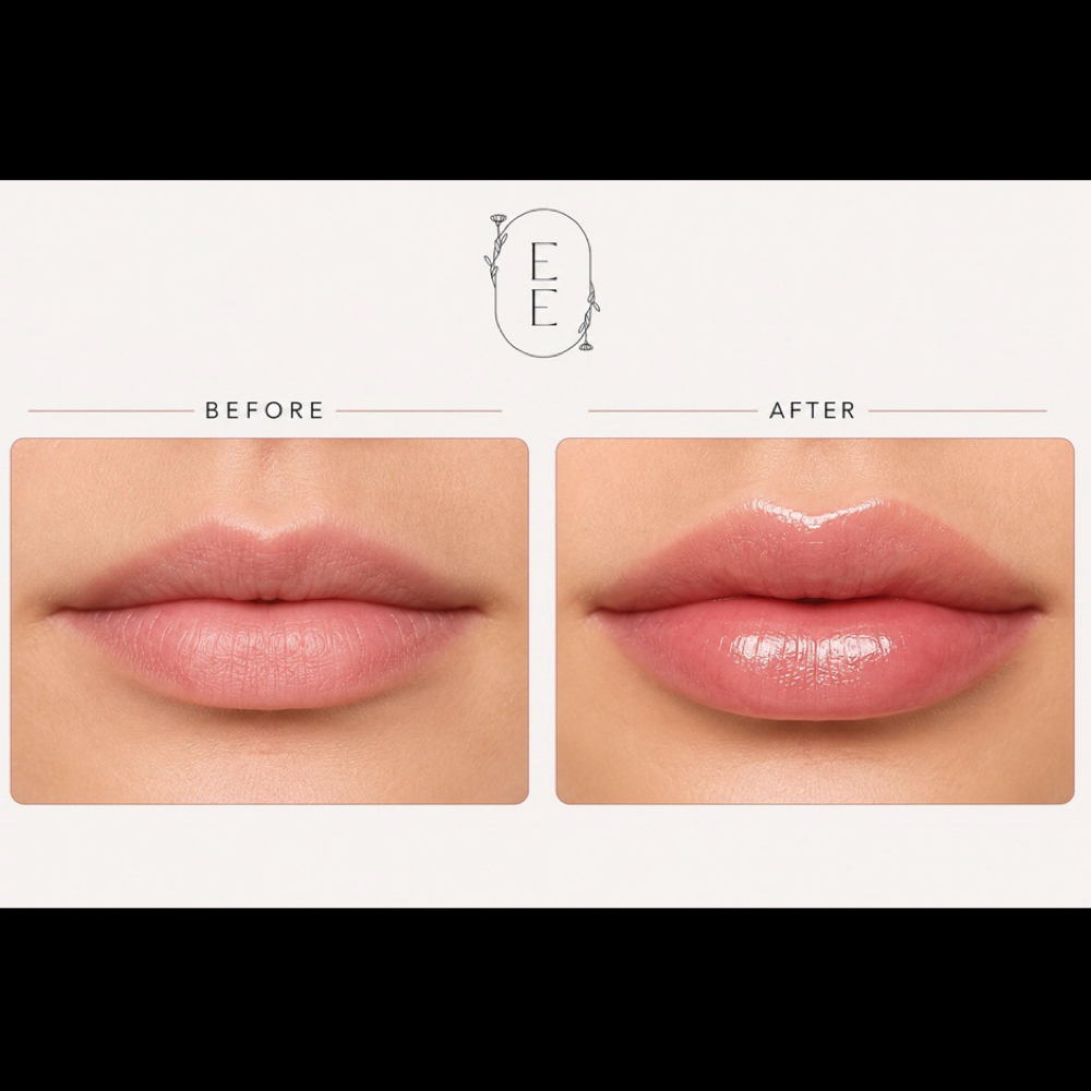Tulip Lip Treatment at Ethereal Esthetics By Ashley in Flagstaff, AZ