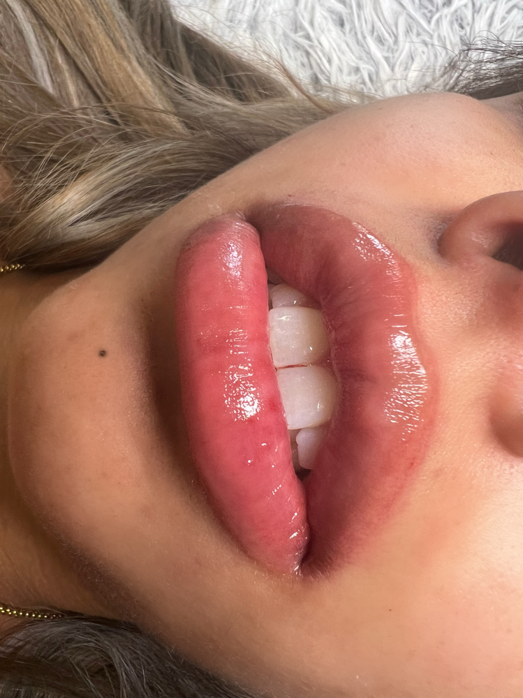 Lip Blushimg