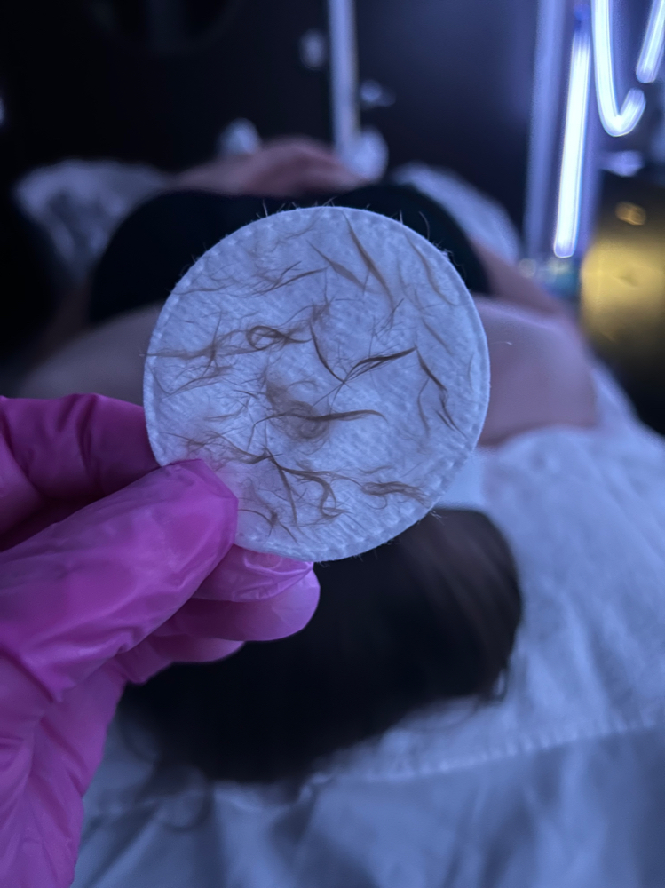 Dermaplane Facial