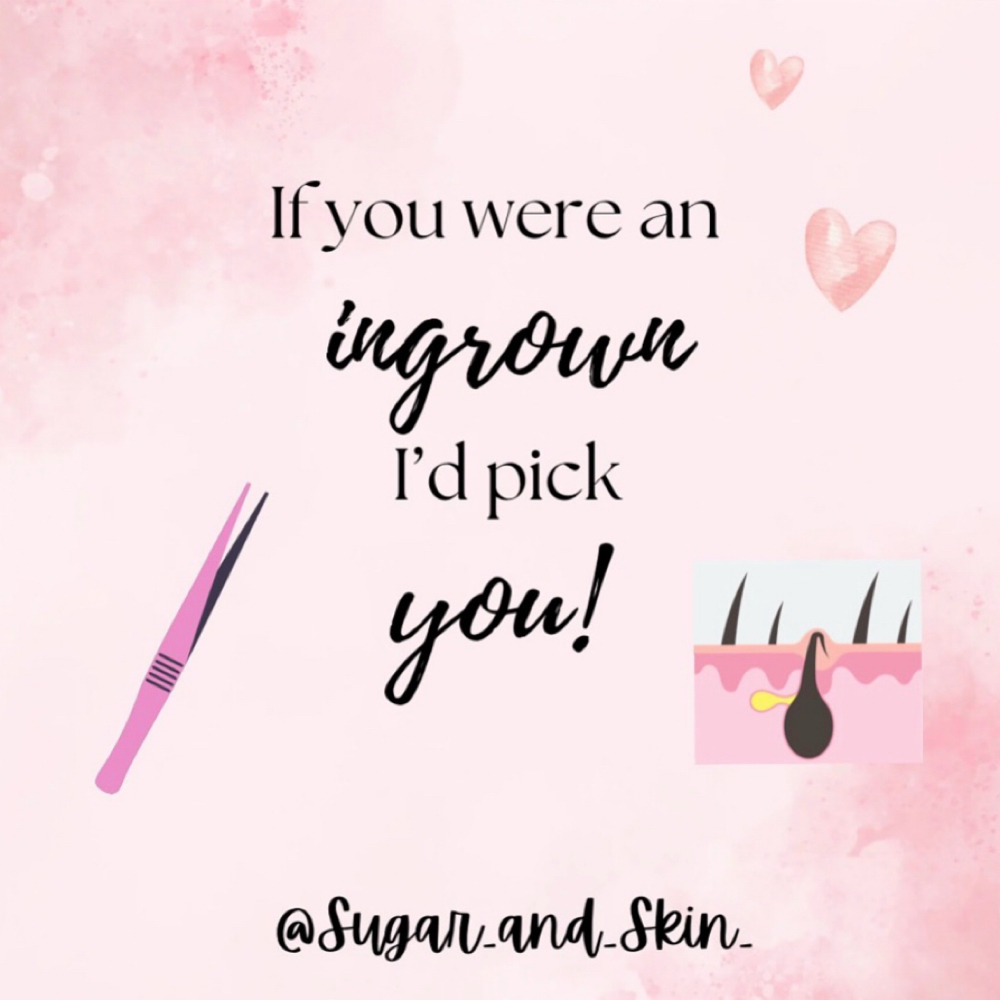 Ingrown Hair-Extractions at Sugar & Skin in Torrance, CA