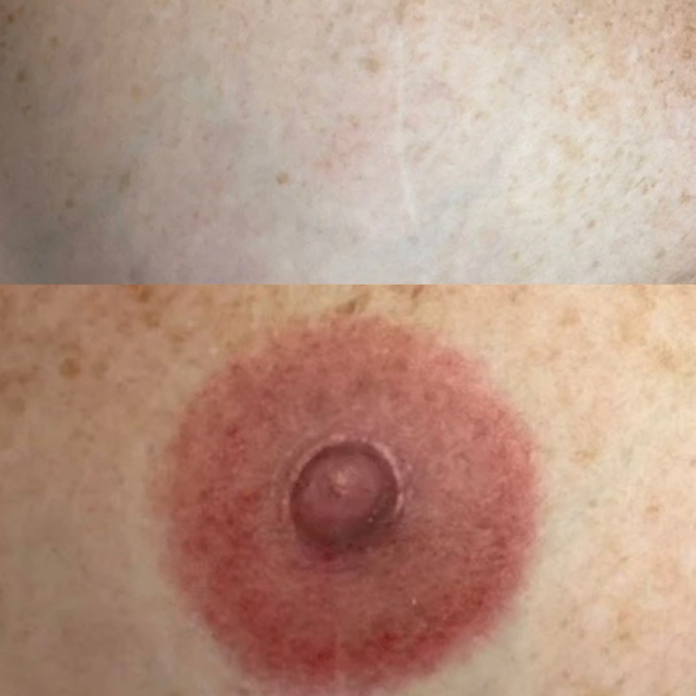 Areola Tattoo at ARRIS BEAUTY in McDonough, GA