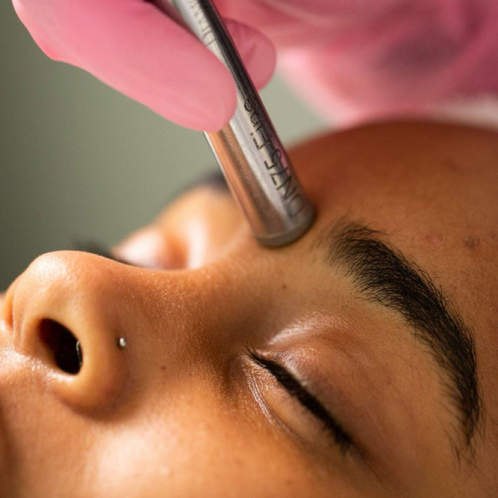 Microdermabrasion Facial Add On at LauLux Esthetics in Bellerose, NY