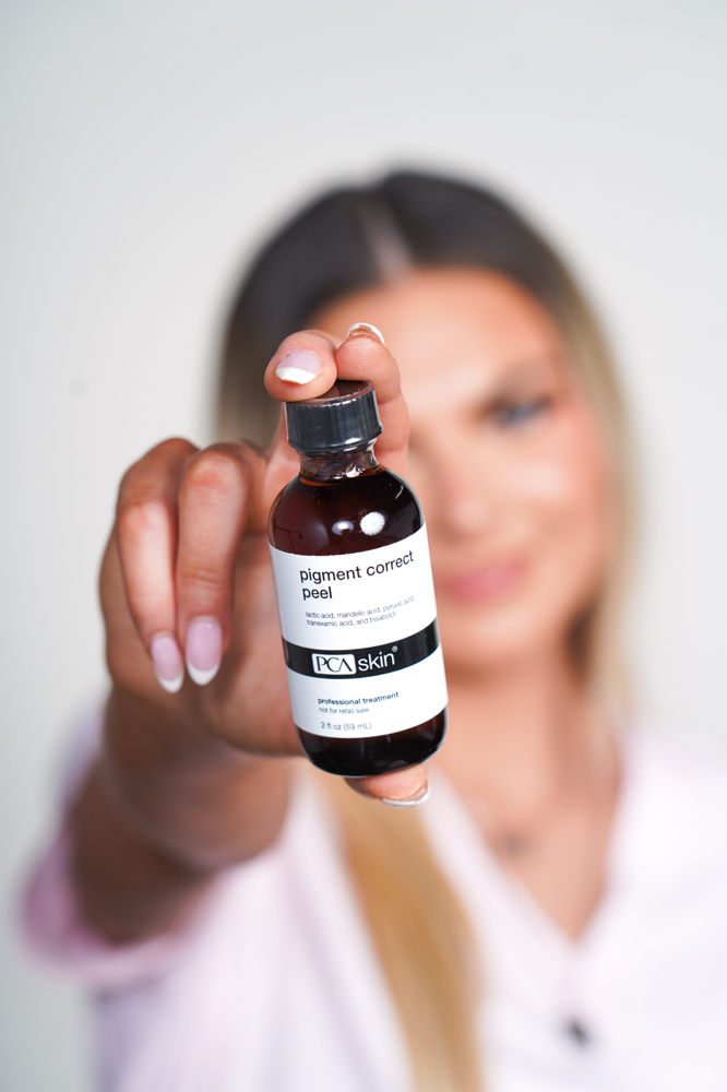 Aura Chemical Peel