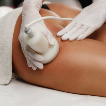 Vacuum Therapy Butt Lift Enhance at Accentuated Body Bar By Gentle LLC in Dallas, TX