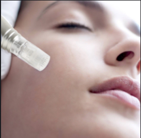 Microneedling