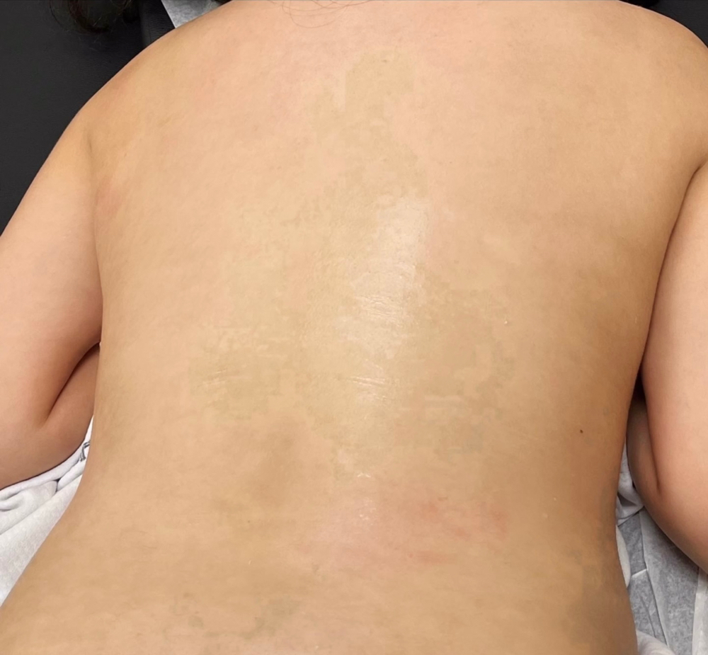 Full Back Wax