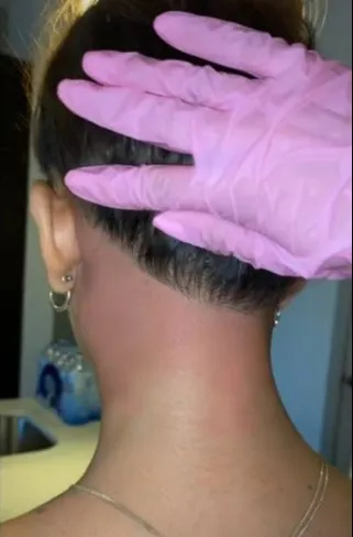 Hair Line Wax