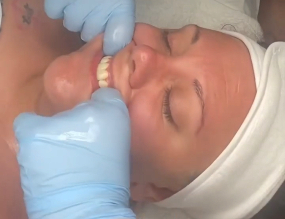 Buccal Massage