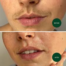 Female or Male Lip Wax