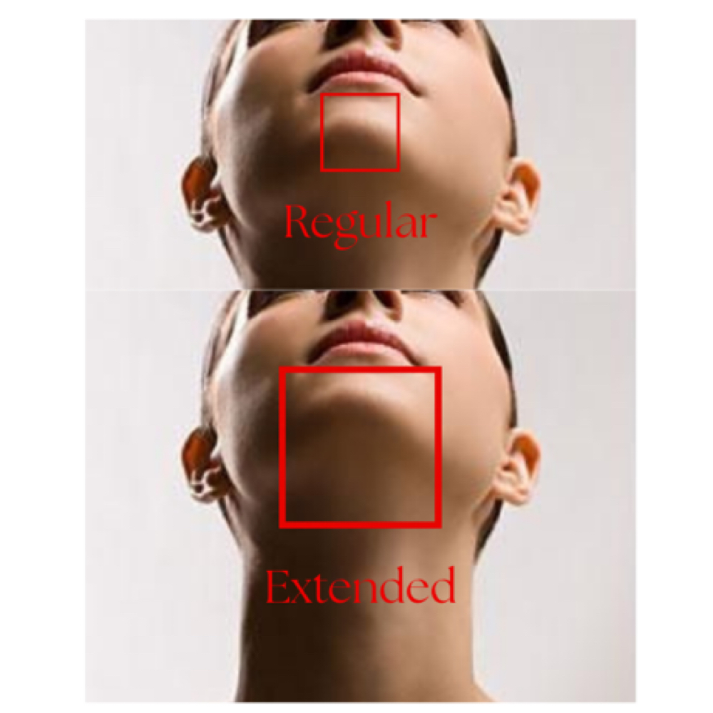 Chin at Glowology Esthetics in Papillion, NE