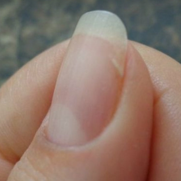 Nail Repair- 1 Nail