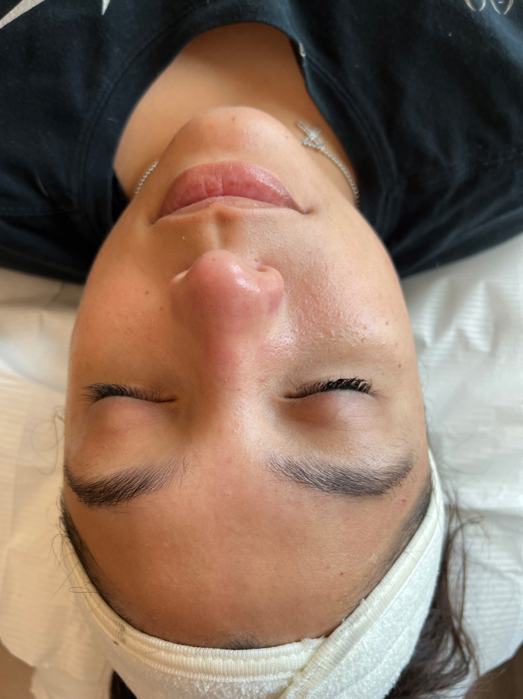 Dermaplaning at Mirada Esthetics in Franklin, TN