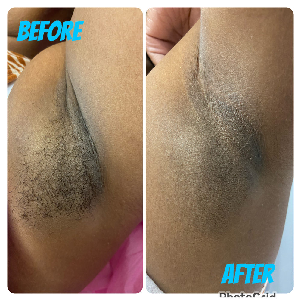 Underarm Wax