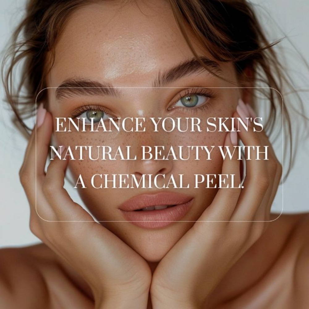 Skin Renewal Peel Series at Bella Glow Skin and Body in San Antonio, TX