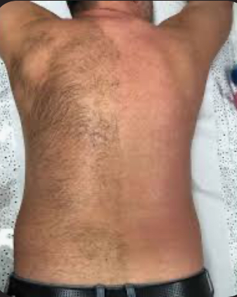 Full Back Wax