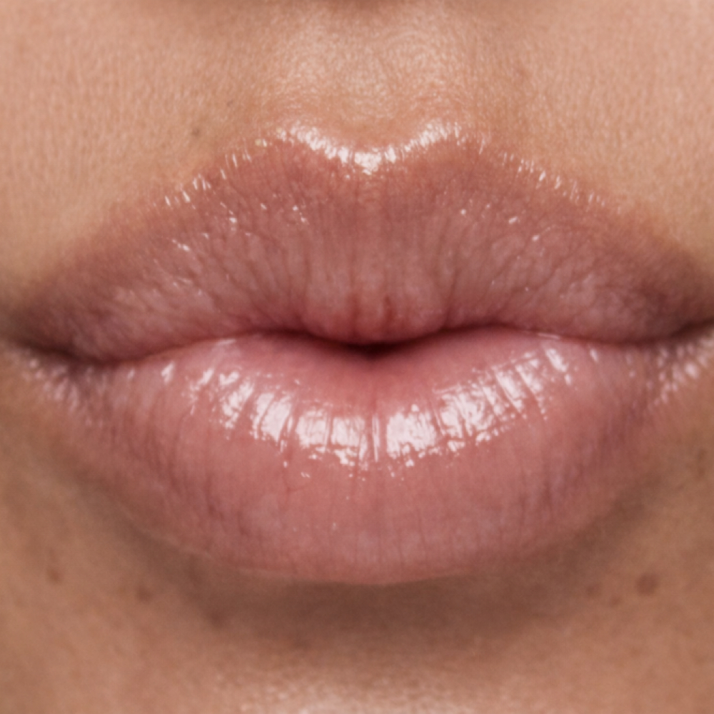 Lip Line Renewal ADD-ON at Sarasota Skin RN in Sarasota skin RN, FL