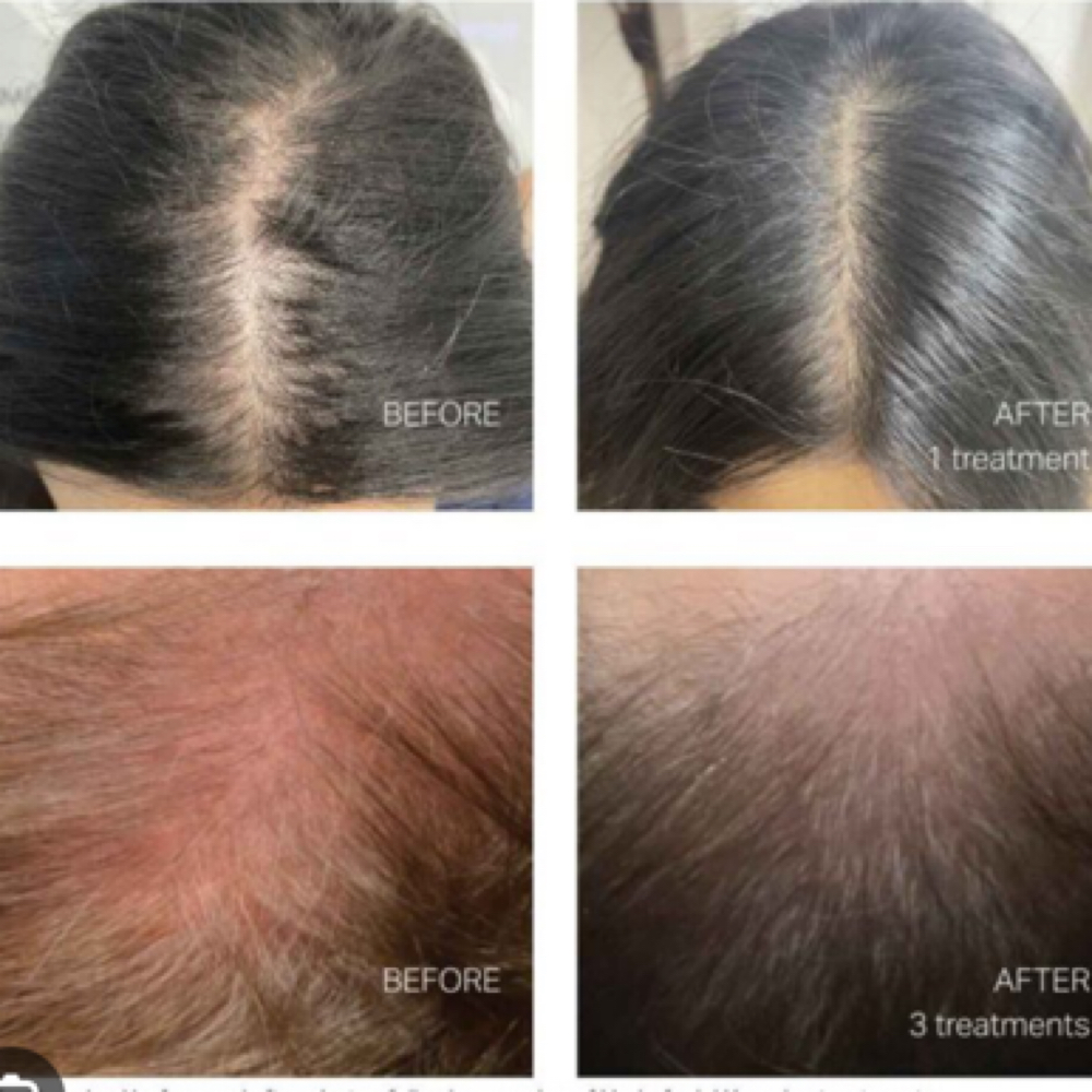 Keravive package of 3 at Beauty And Body in San Dimas, CA