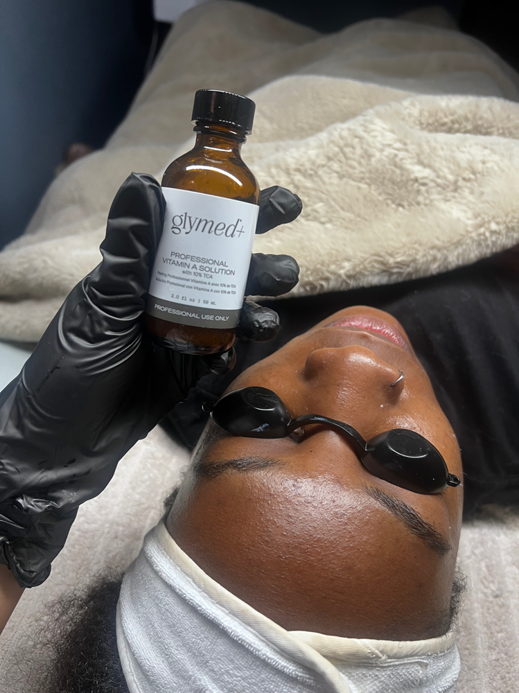 TCA 15% Peel Series