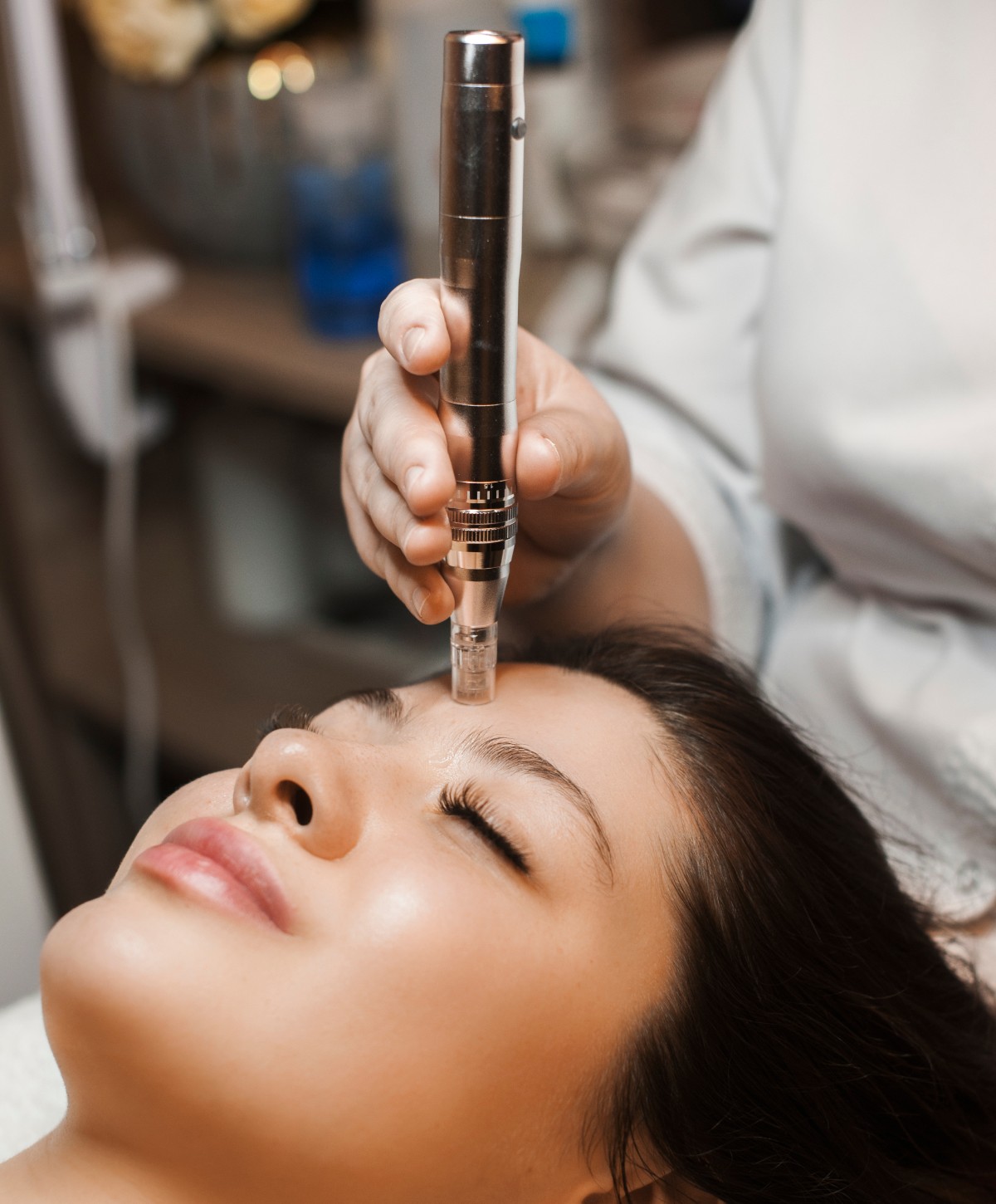 Microneedling with PRP (Plasma)