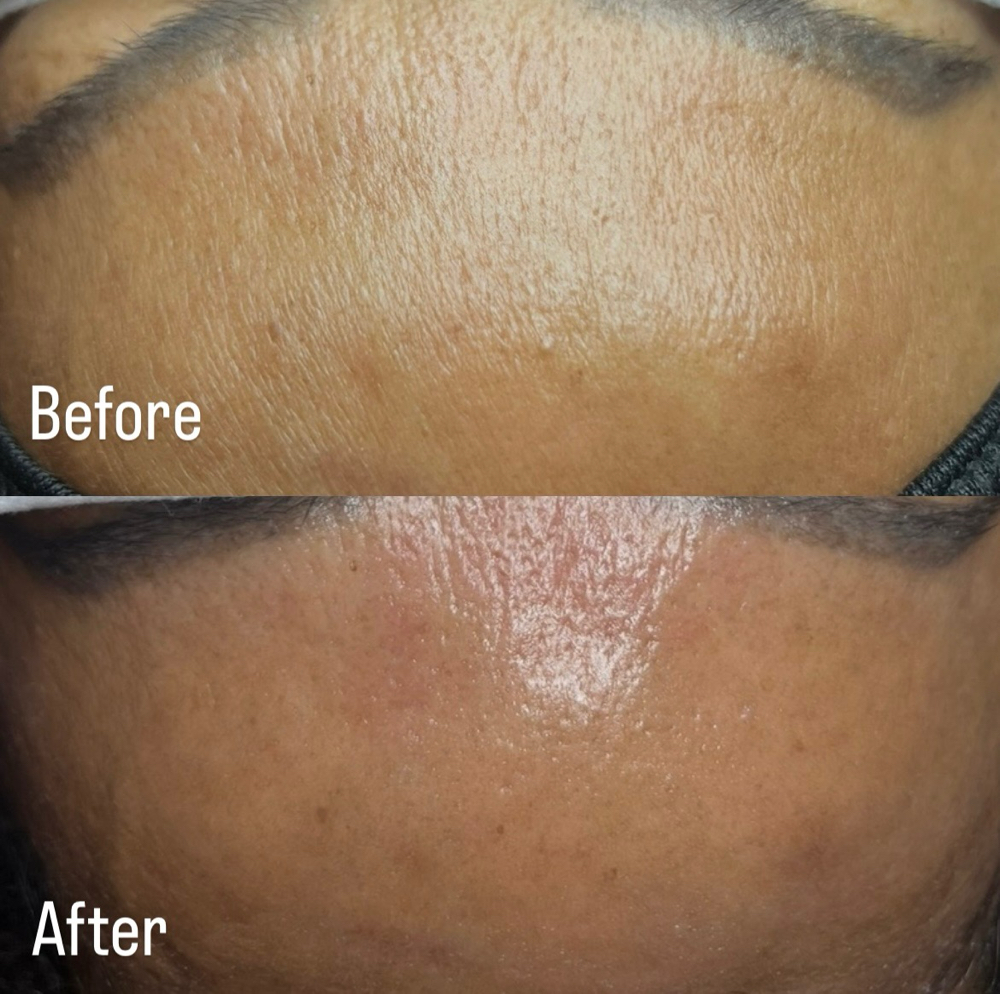 Glow Me Facial