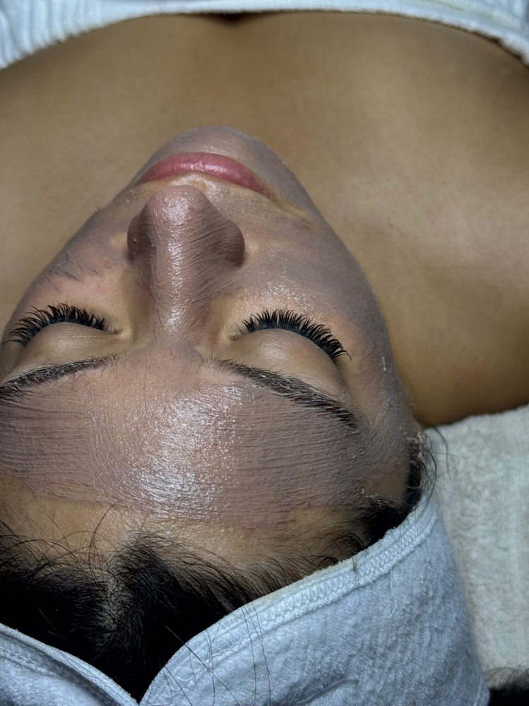 Microdermabrasion Facial