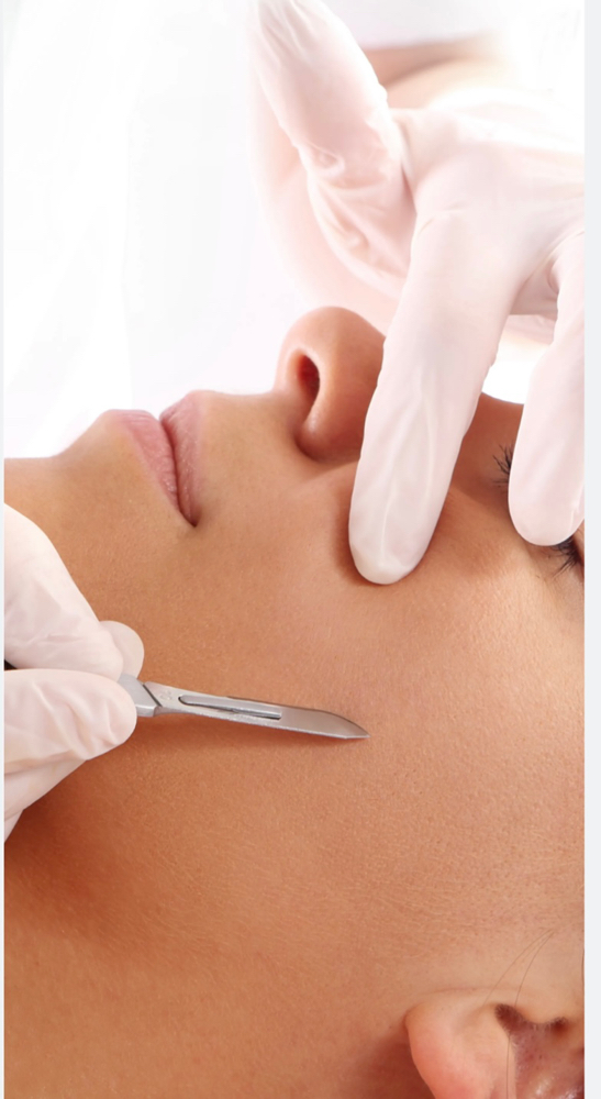 Dermaplaning