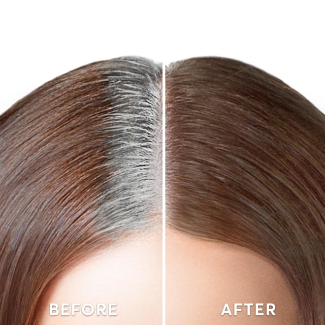 Root Touch-Up