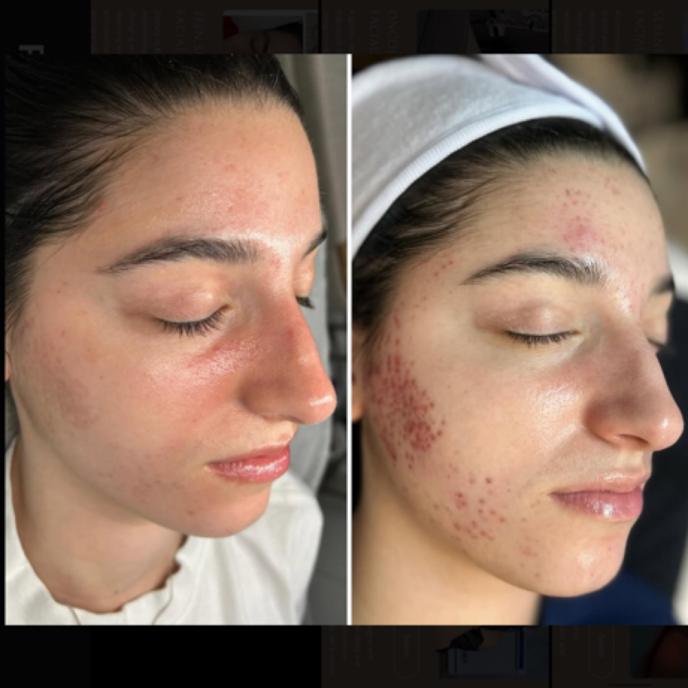 Advanced Corrective at Serenity By Sarina in Riverside, RI