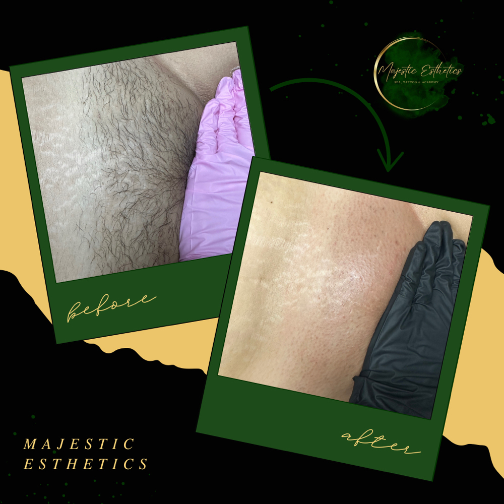 Brazilian Wax + Inner Thigh at Majestic Esthetics in Vacaville, CA