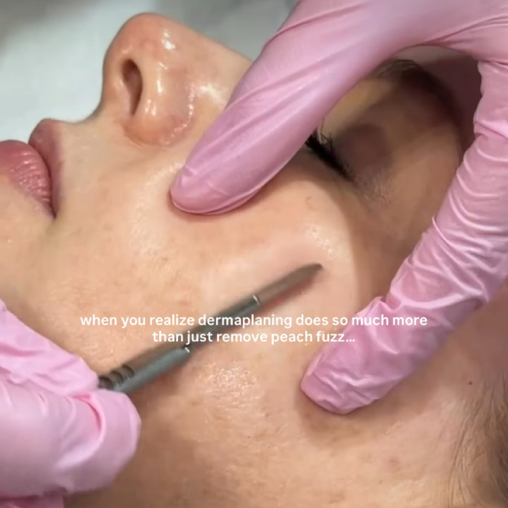 Dermaplaning at Heavenly Esthetics Skincare in Latham, NY