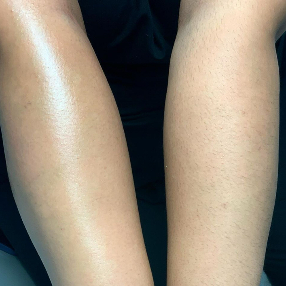 Half Arm Wax at Skin by Gia in Pueblo, CO