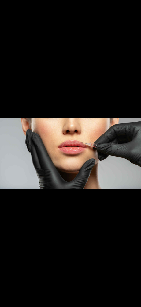 Lip Flip at Lush MedSpa & IV Lounge in Middlesboro, KY