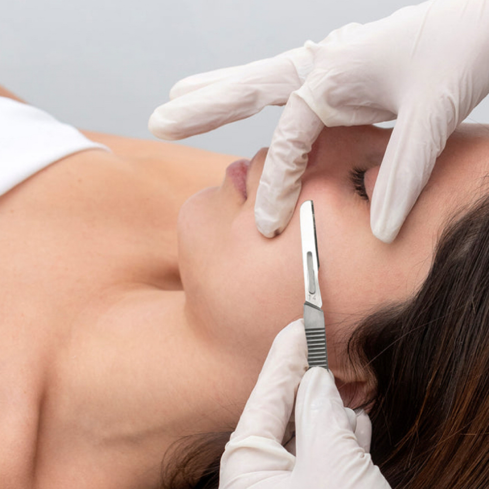 Dermaplane at BellaFace in Excelsior, MN