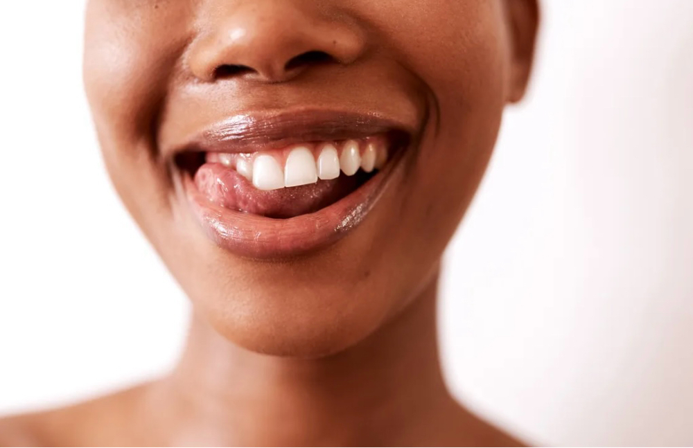 Teeth Whitening Package
