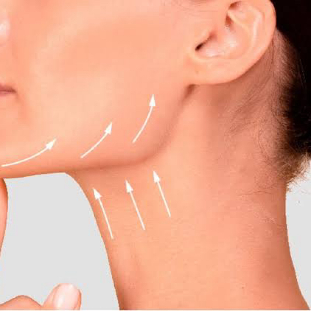 Nefertiti Lift at Refyned Aesthetics & Wellness in Greenville, TX