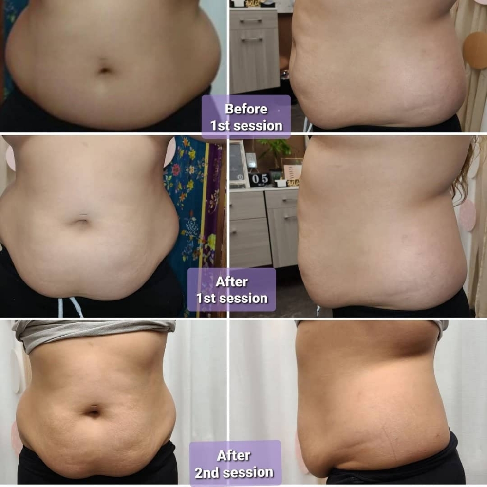 1area body 1sessions