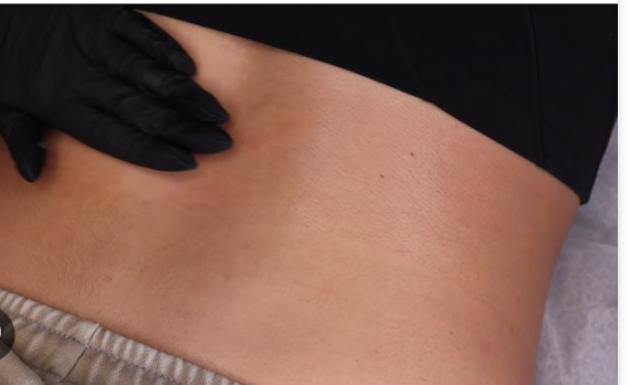 Lower Back